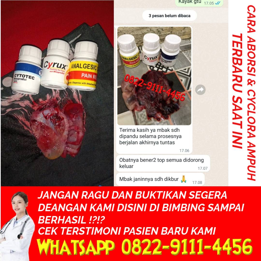 Cara Aborsi paling Ampuh dan Cara Menggugurkan Kandungan 1 sampai 8 bulan